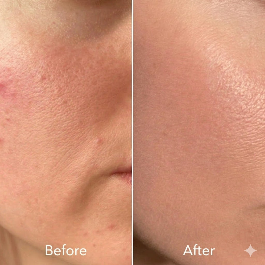 PDRN Pink Peptide Serum (95ml)
